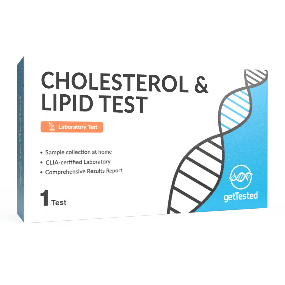 Cholesterol & Lipid Test