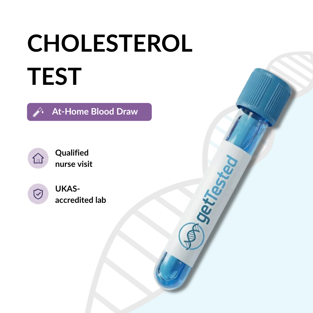 Cholesterol Test