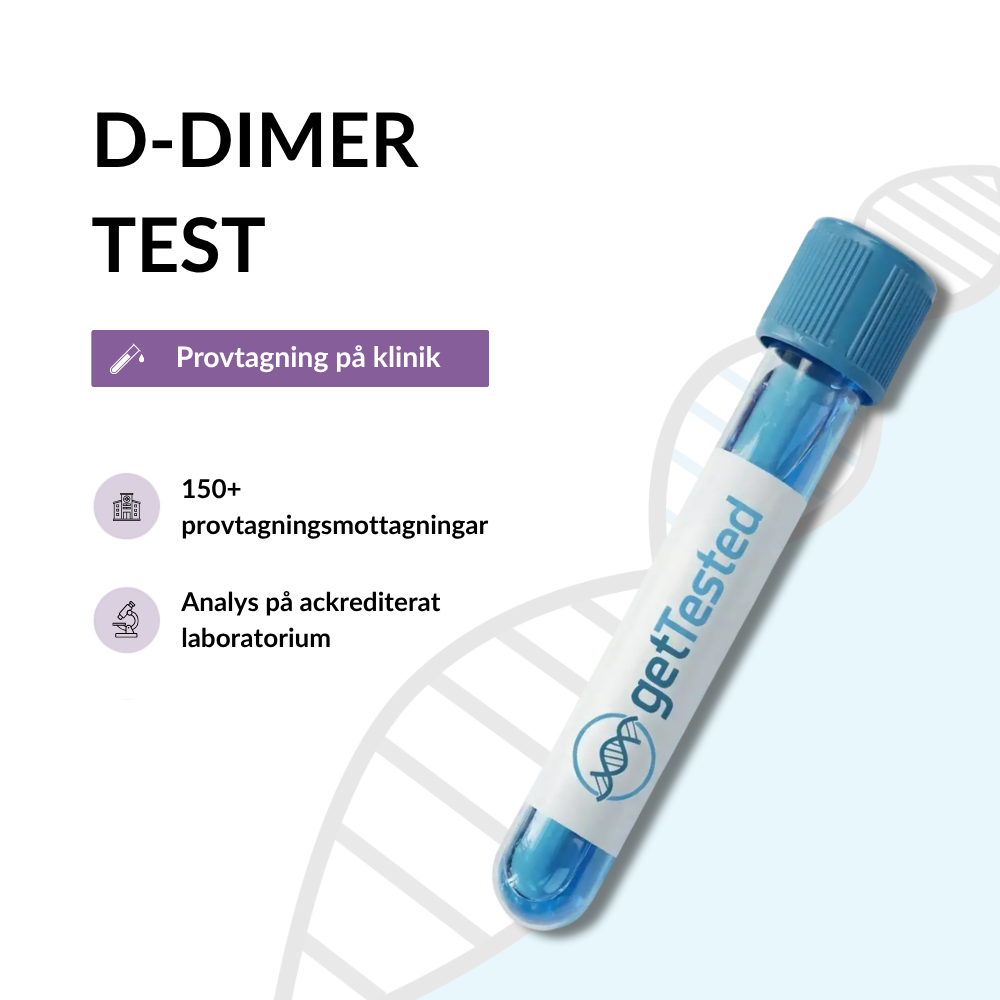 D-Dimer Test