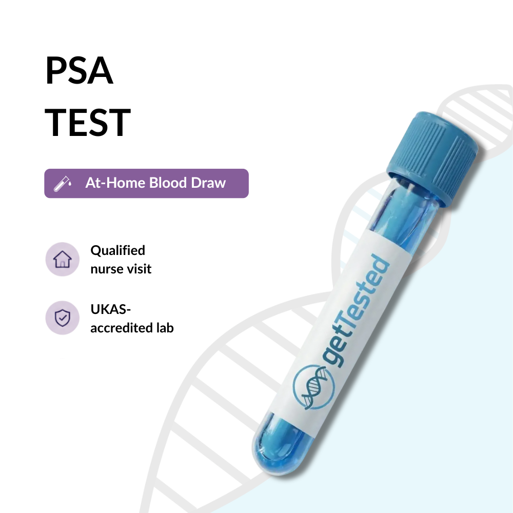 PSA Test