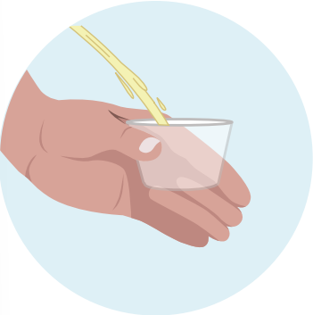 Collect the urine  - image 1