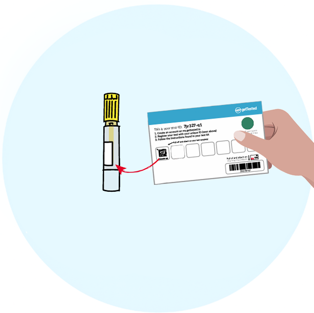 Test ID On Yellow Stool Tube - image 1