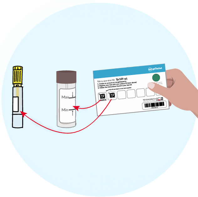 Attach Test ID On Yellow And Brown Tube - image 1