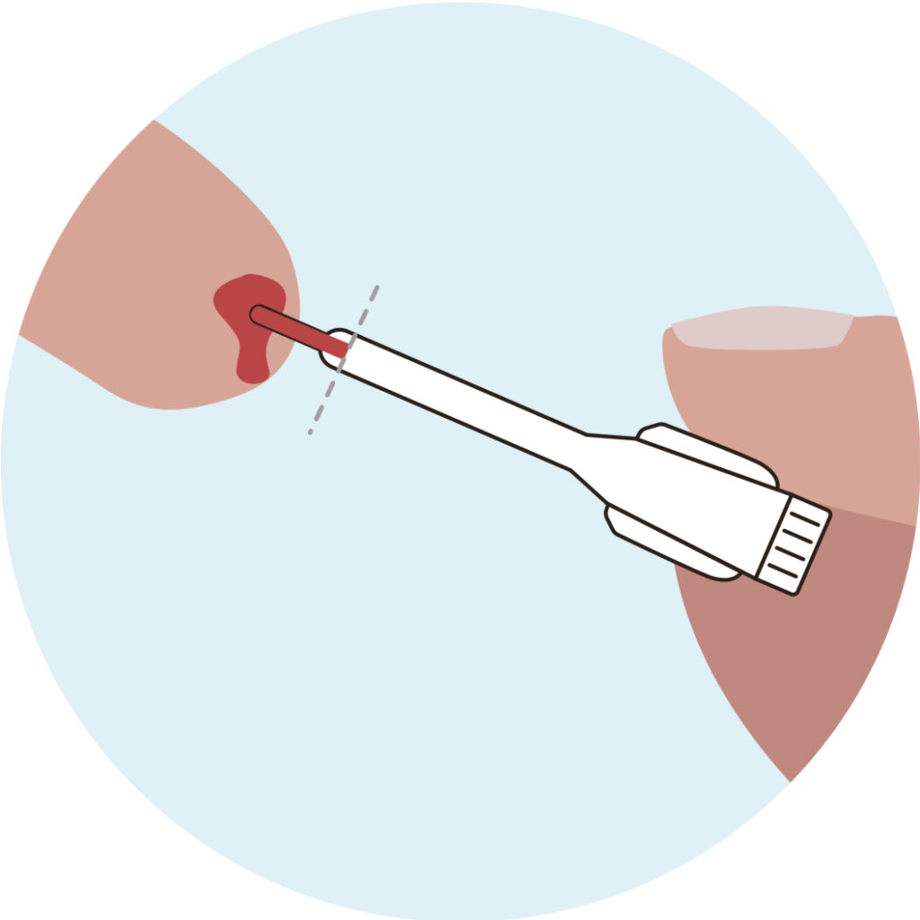 Collect Blood WIth Dropper - image 1
