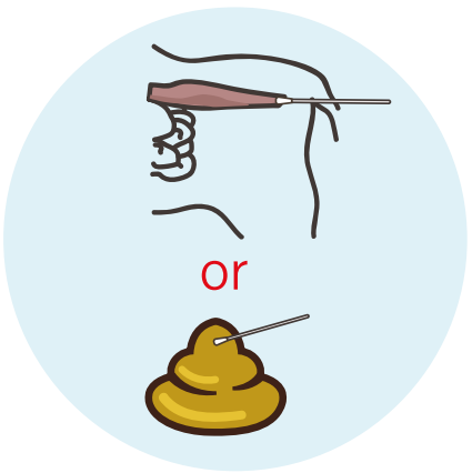 Collect Stool / Vomit Sample - image 1