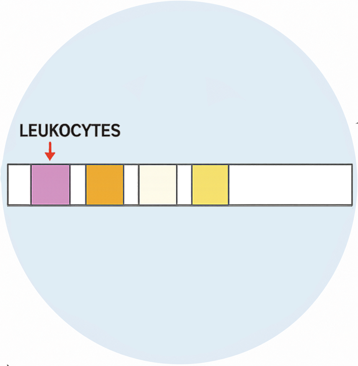 Positive: Leukocytes - image 1